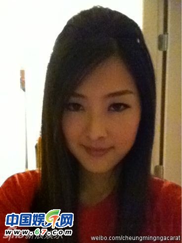 有人爆料指張名雅做過四次整形手術(shù)，還提供了一張疑似張名雅的舊照(左圖)