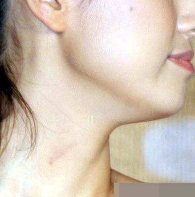 帶吻痕到處招搖 真不害臊哦