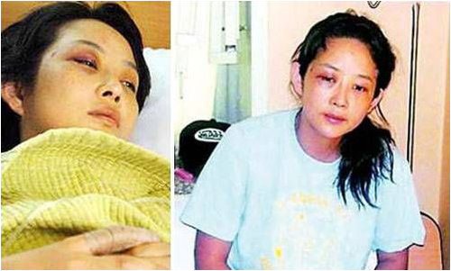 殘忍的明星家暴 太慘了！