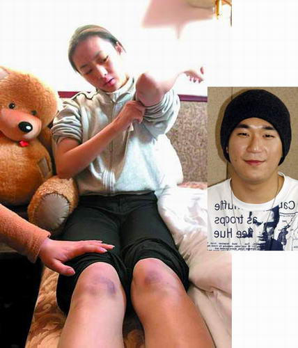 殘忍的明星家暴 太慘了！