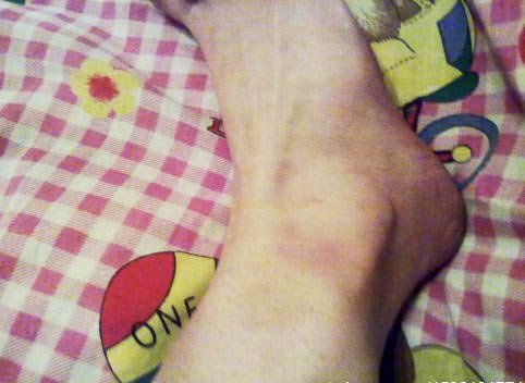 殘忍的明星家暴 太慘了！