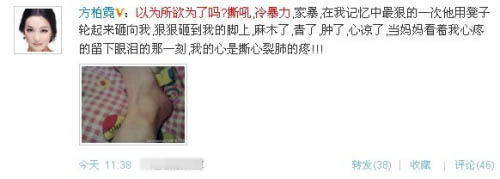 殘忍的明星家暴 太慘了！