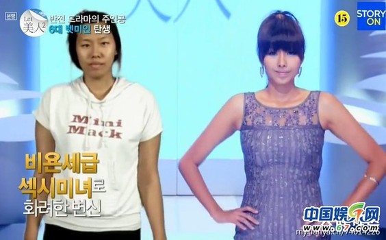 多圖劇透韓國整容節(jié)目《LET 美人》近幾期，最愛小V臉，人瘦就能美