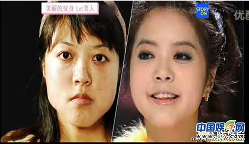 多圖劇透韓國整容節(jié)目《LET 美人》近幾期，最愛小V臉，人瘦就能美