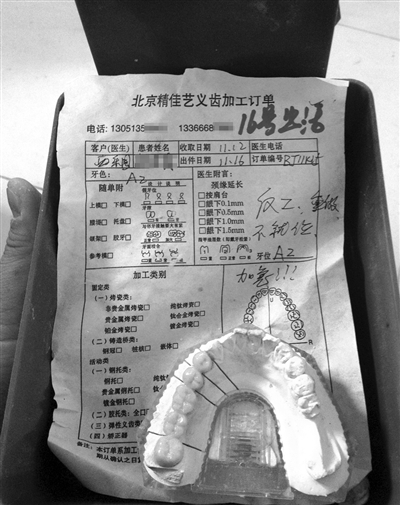 精佳藝義齒加工訂單顯示“反（返）工、重做”等字樣，一名骨干業(yè)務員說，該廠產(chǎn)品返工率占兩成。