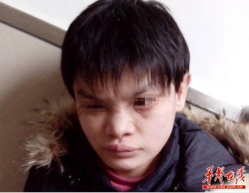 近日，十堰市兒童福利院被曝虐待兒童，其中7名兒童在2012年冬季被活活凍死，引發(fā)廣泛關(guān)注。 網(wǎng)絡(luò)截圖